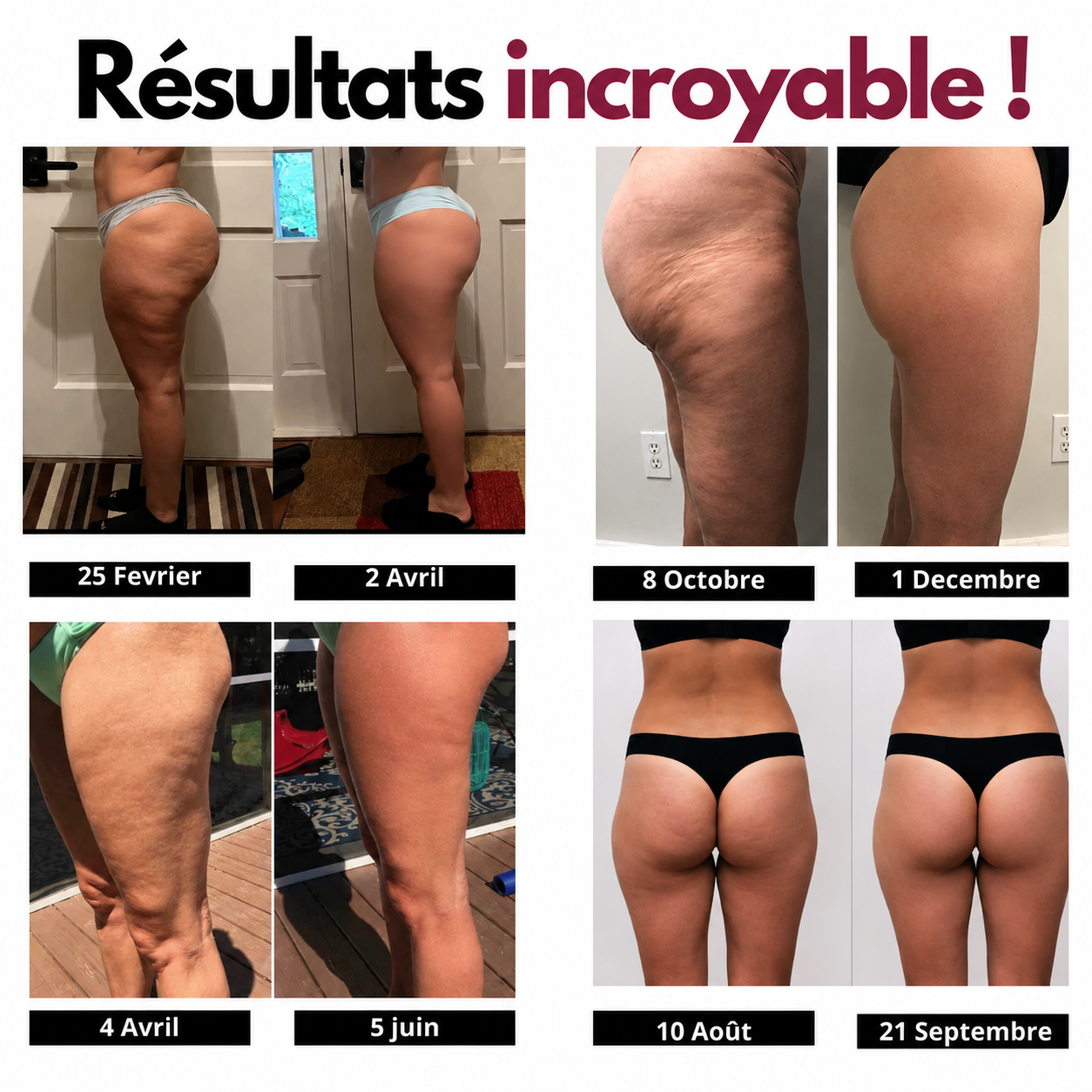 Culotte Sculptante Anti-Cellulite