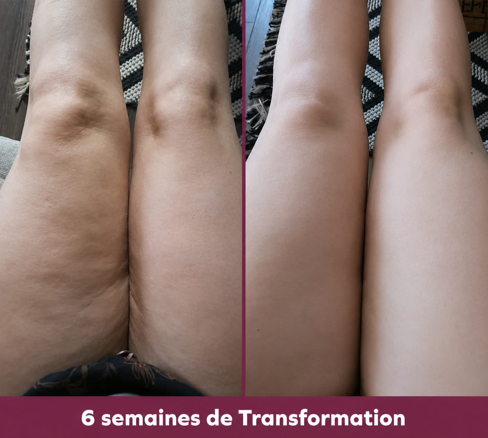 Avant-Après Marie 43 ans